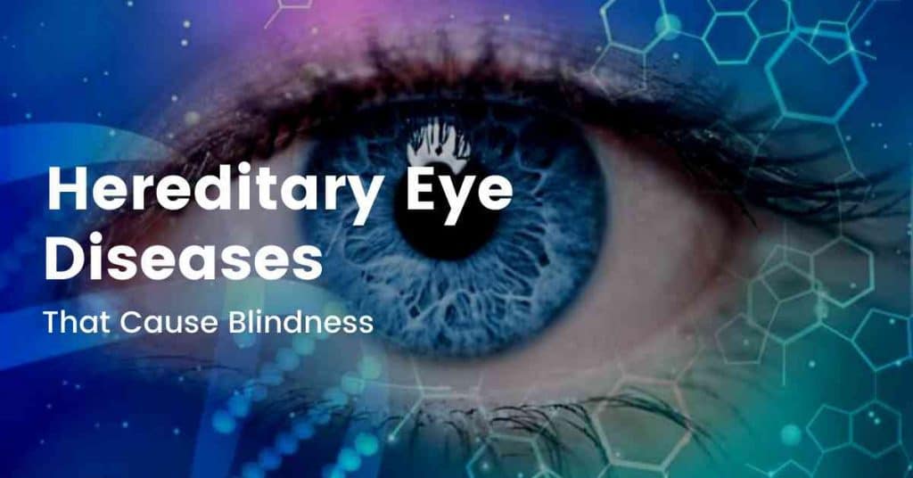 Hereditary eye diseases that cause blindness EyesOPT