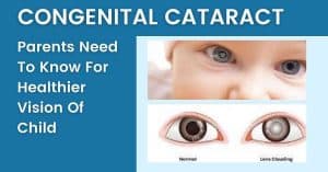 Read more about the article Congenital Cataract: Parents need to know