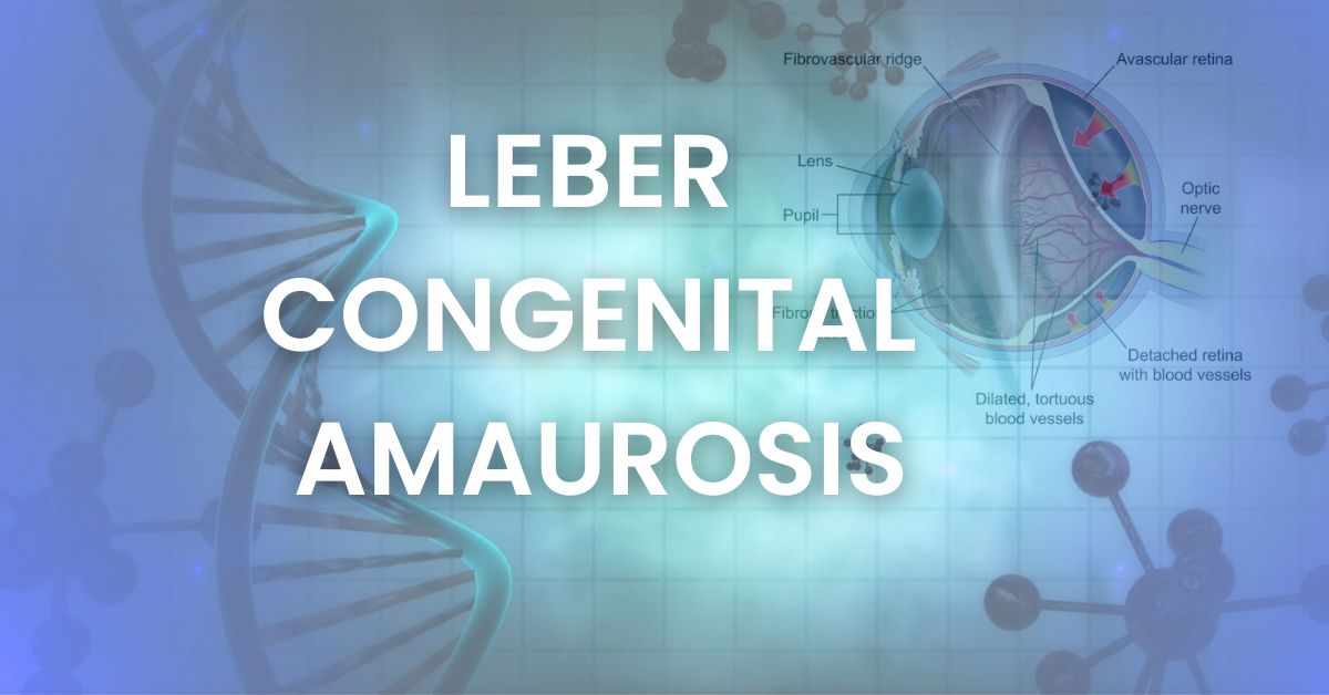 Leber Congenital Amaurosis EyesOPT