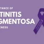 Retinitis Pigmentosa Awareness: Why It Is Important?