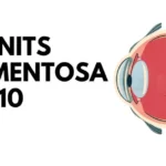 Retinitis Pigmentosa ICD-10: Analyze the Genetic Eye Condition